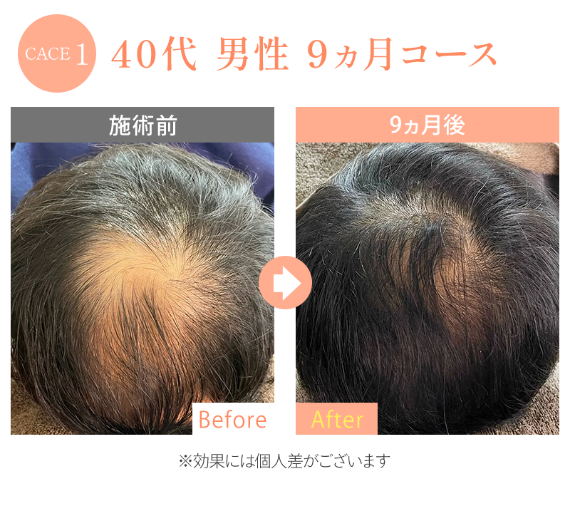 ビフォーアフター