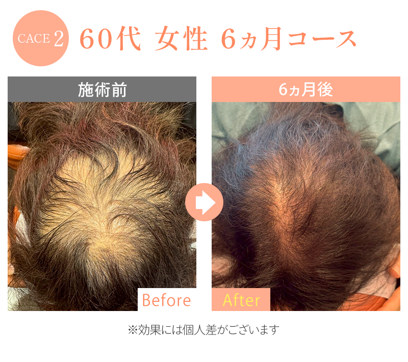 ビフォーアフター