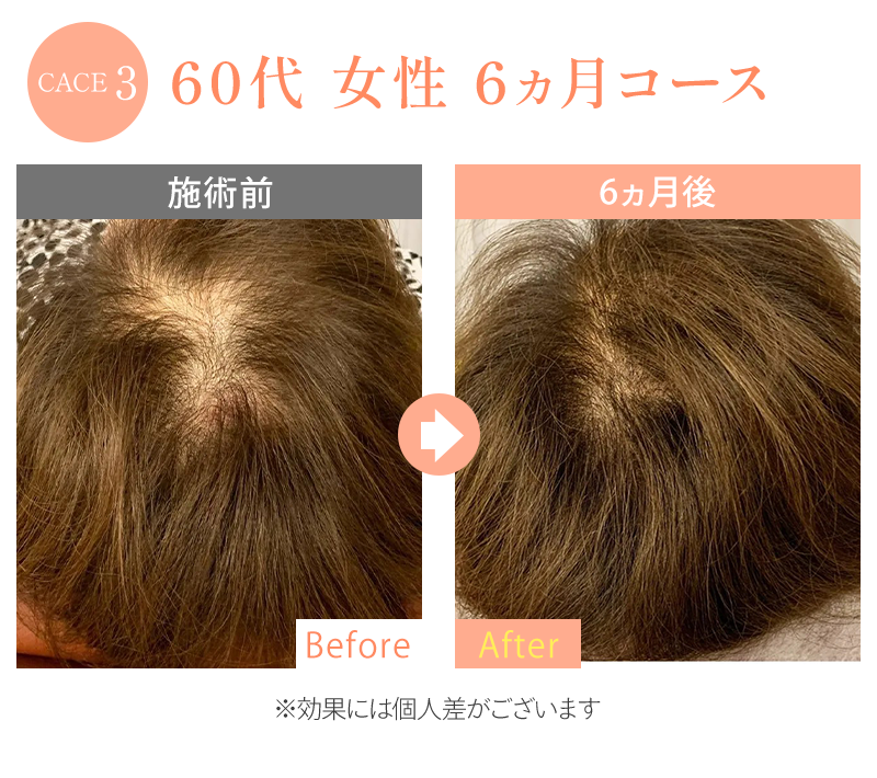 ビフォーアフター