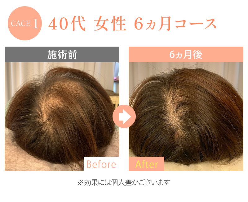 ビフォーアフター