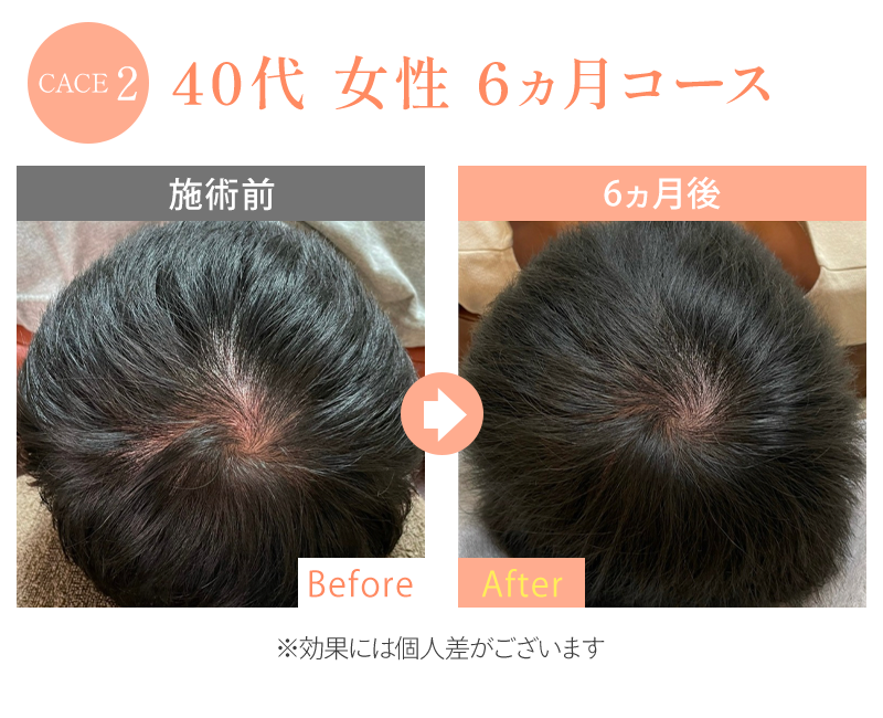 ビフォーアフター