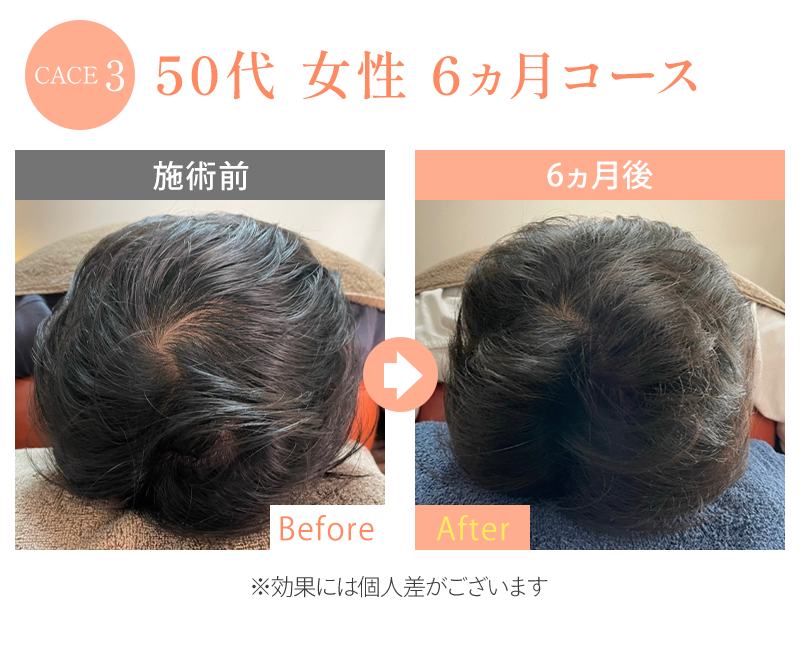 ビフォーアフター