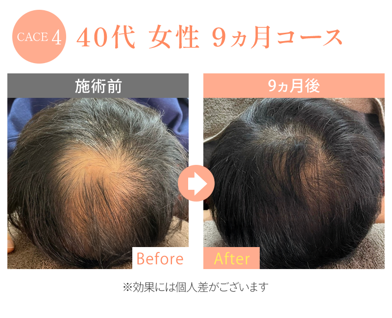 ビフォーアフター