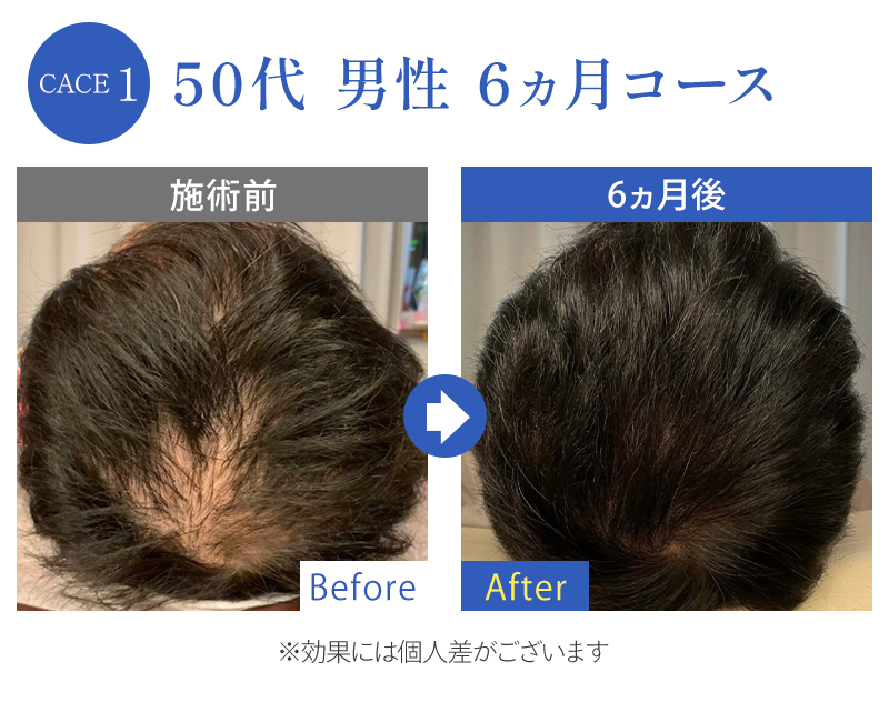 ビフォーアフター