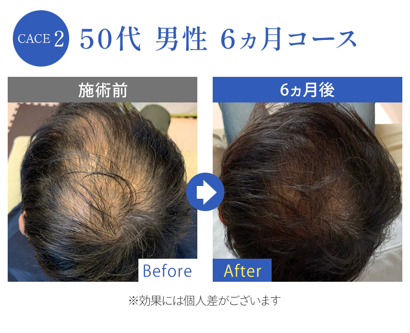 ビフォーアフター