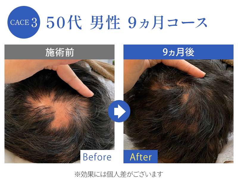 ビフォーアフター